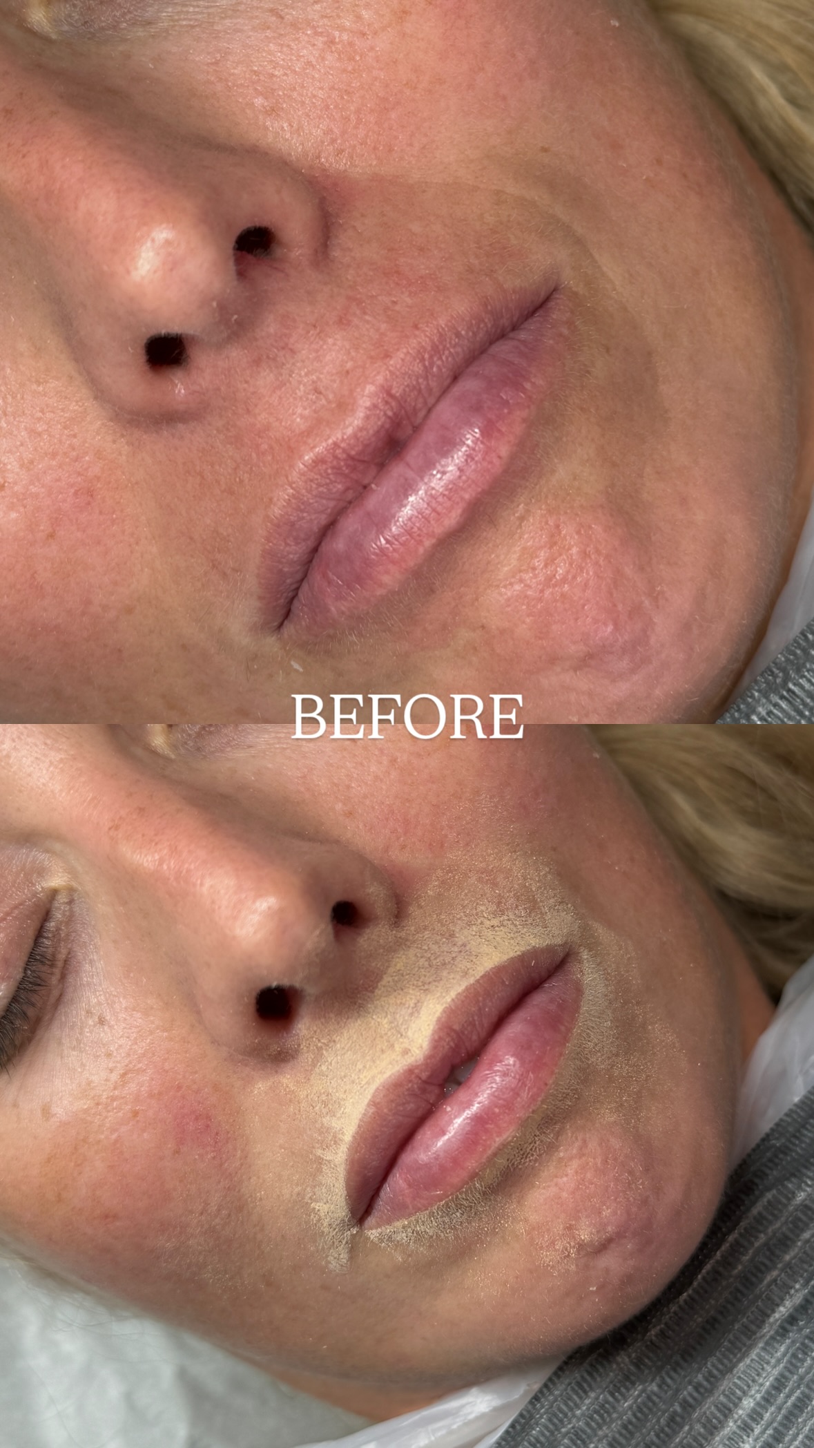 Fresh lip blush tattoo before and after