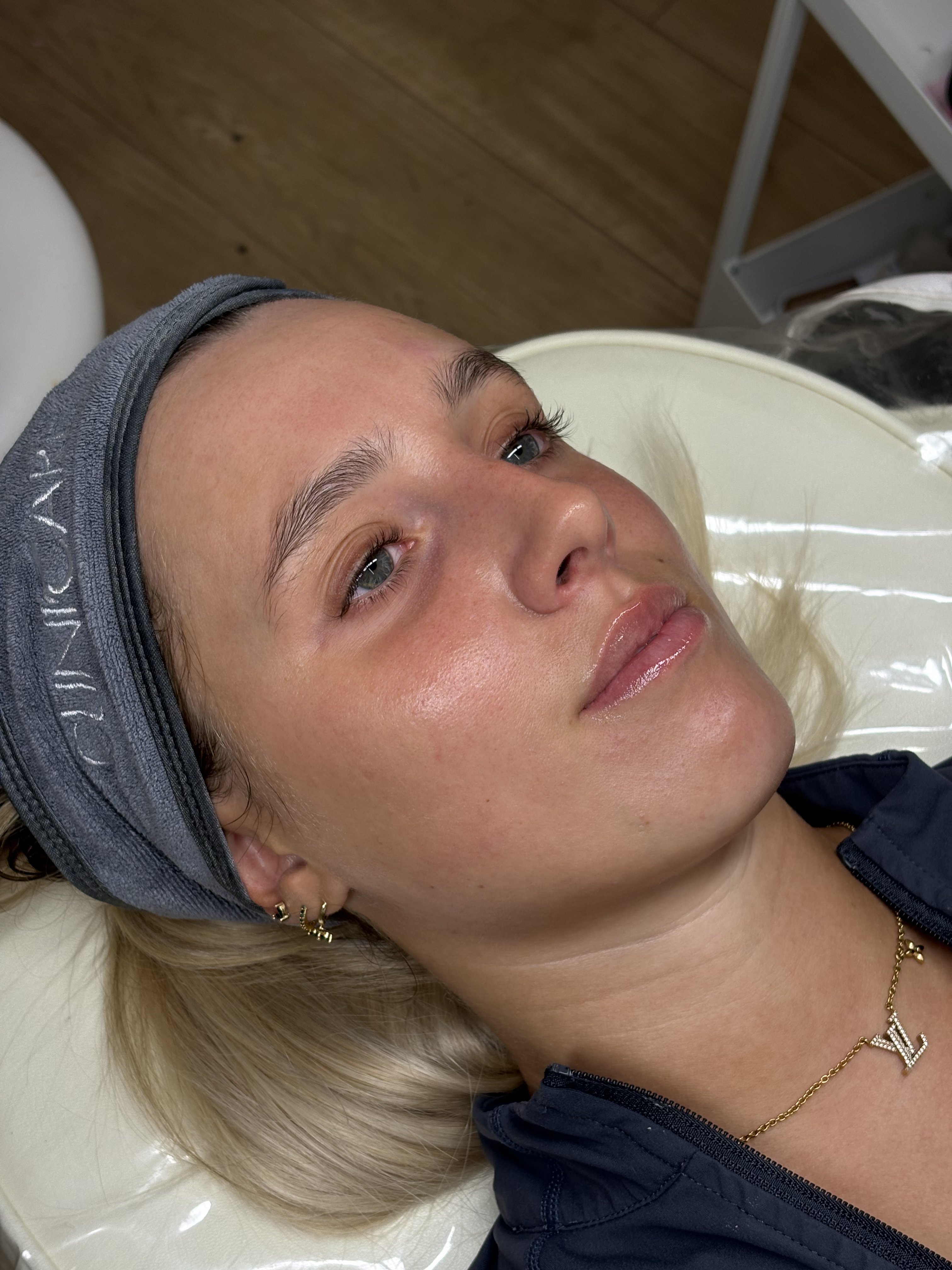 Glowing skin result with Cliniccare headband