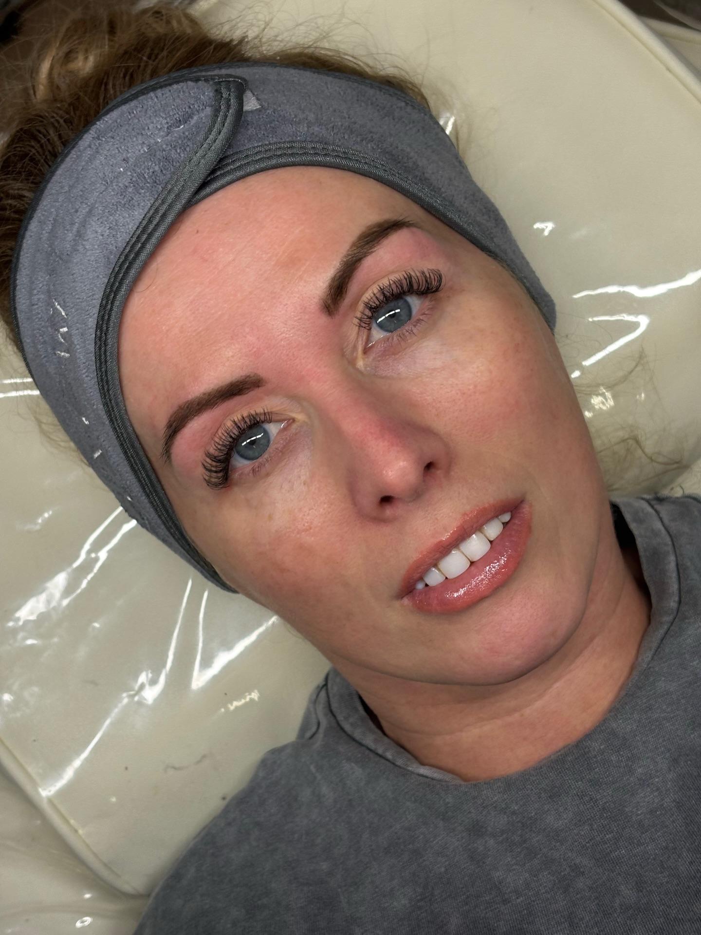 LED light therapy treatment