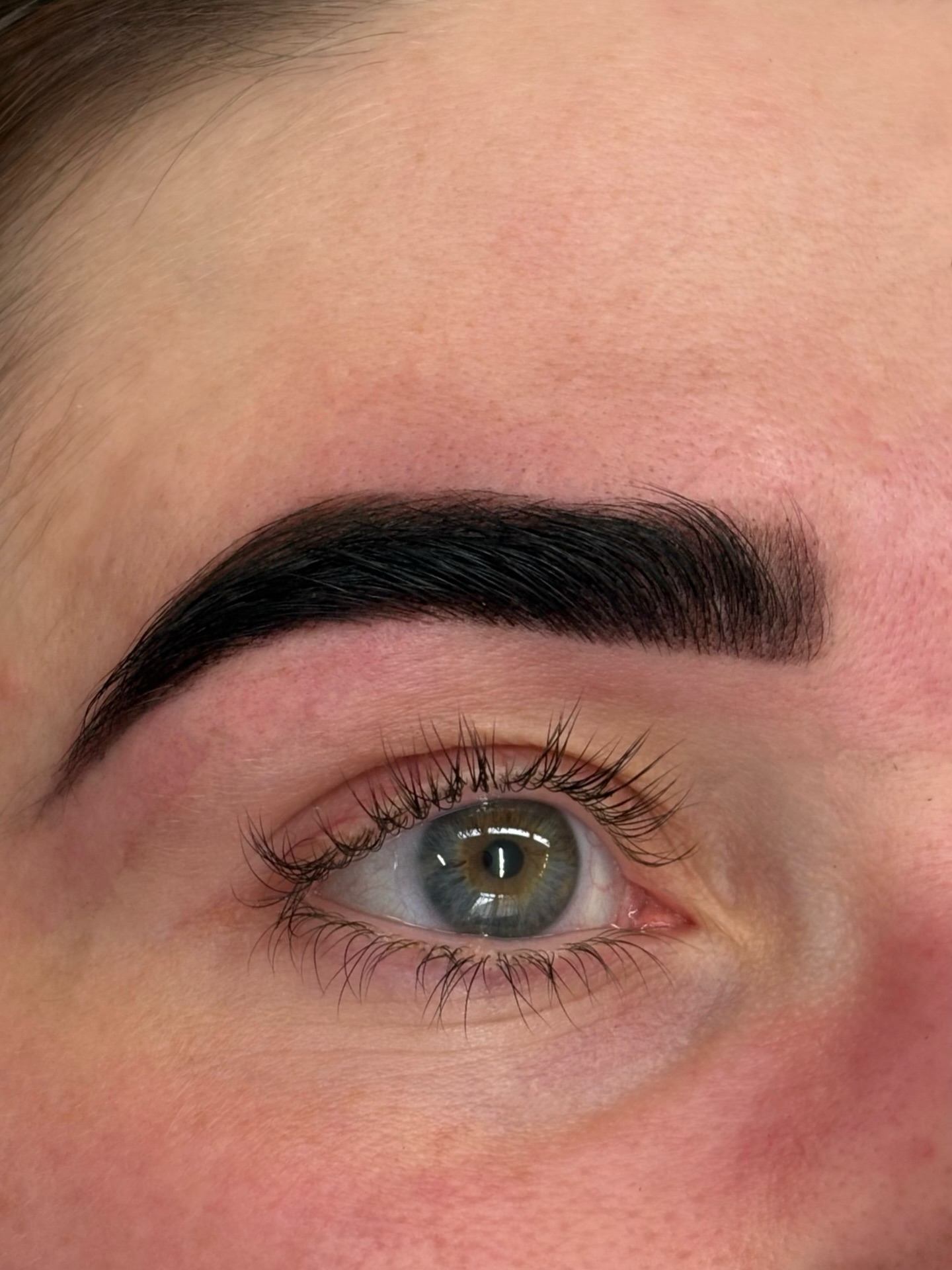 Treatment close-up