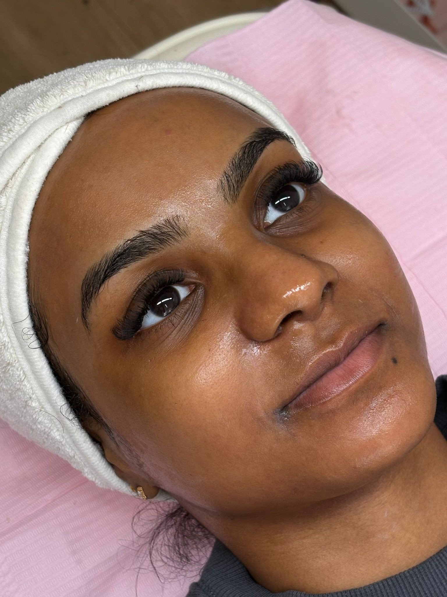 Skin and lash treatment result